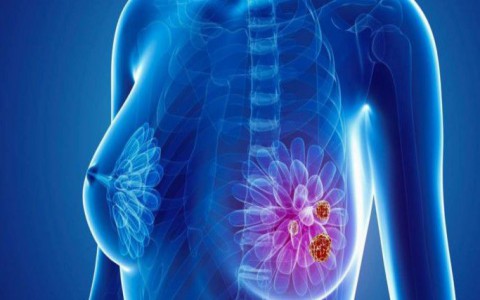 10 loại thực phẩm thiên nhiên chống ung thư vú